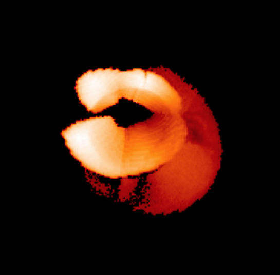 Refer to caption