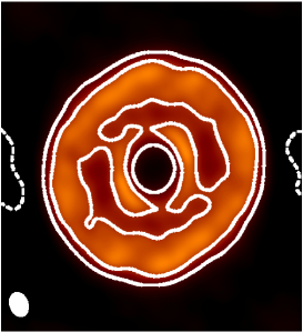 Refer to caption