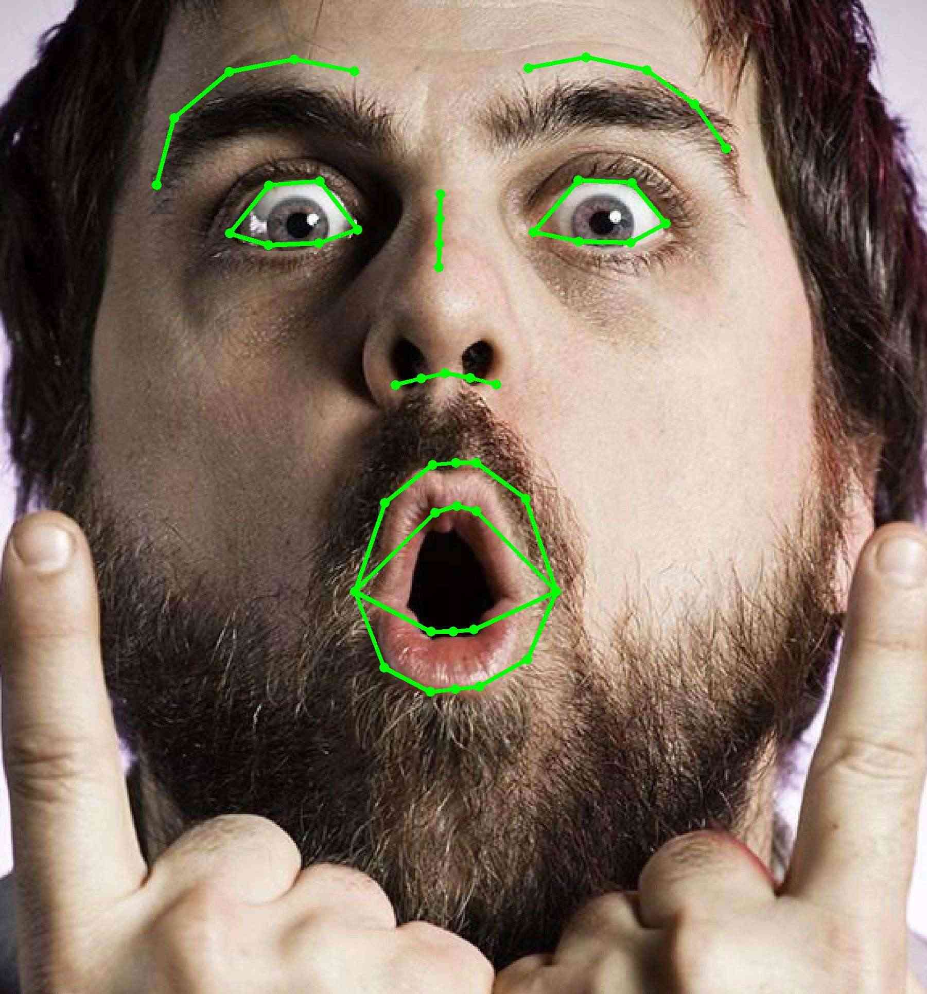 Refer to caption