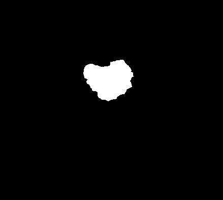 Refer to caption