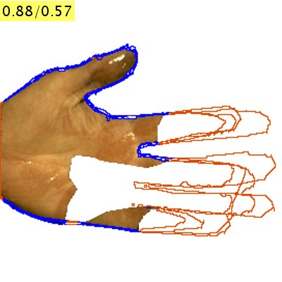 Refer to caption