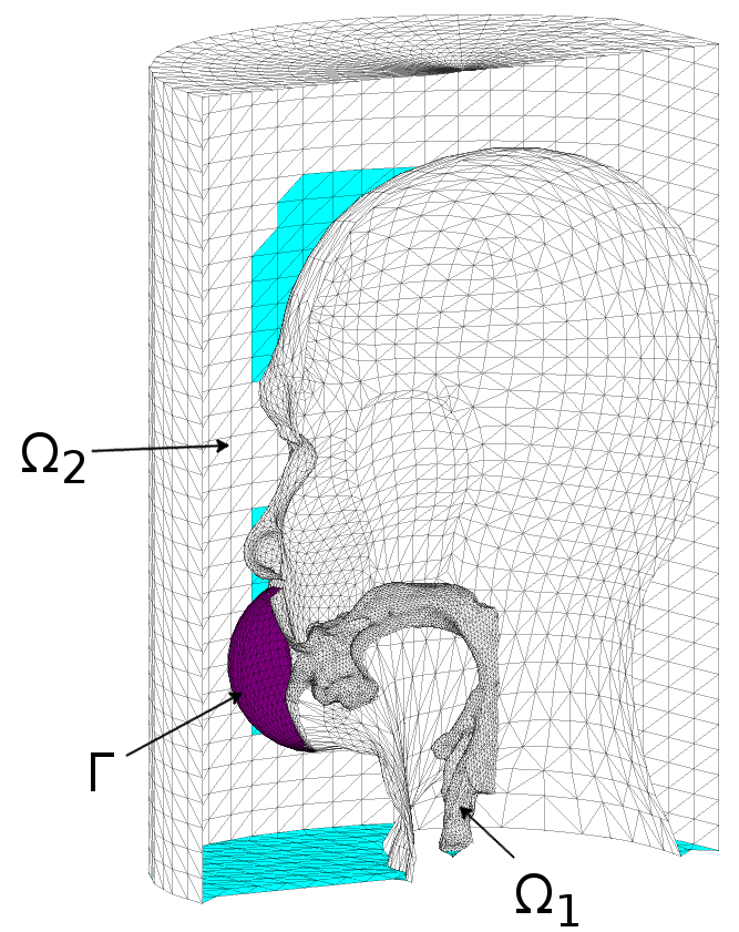 Refer to caption