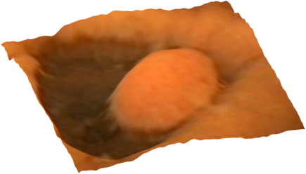 Refer to caption