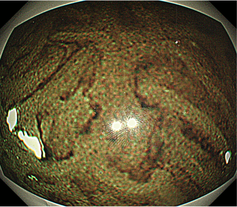 Refer to caption