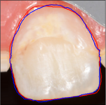 Refer to caption