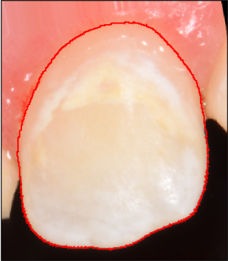 Refer to caption