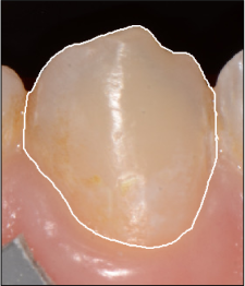 Refer to caption