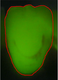 Refer to caption