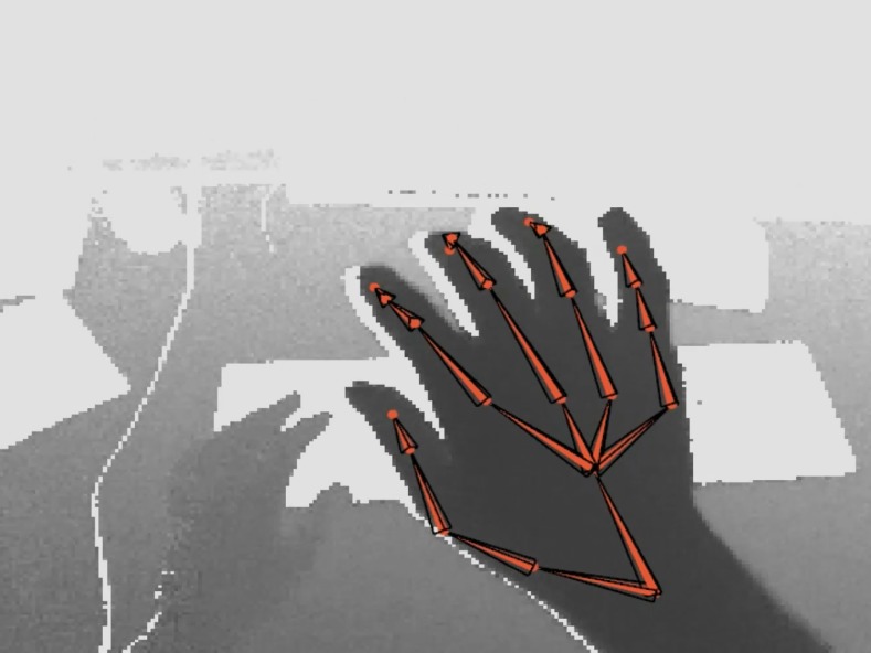 Refer to caption