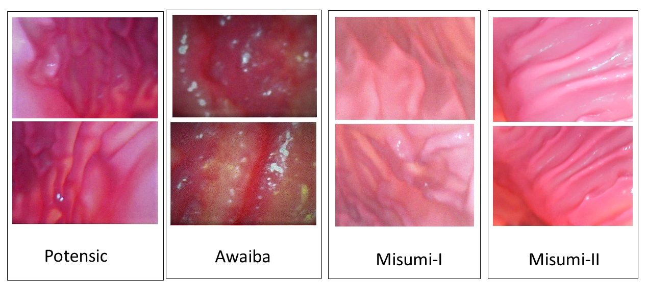 Refer to caption