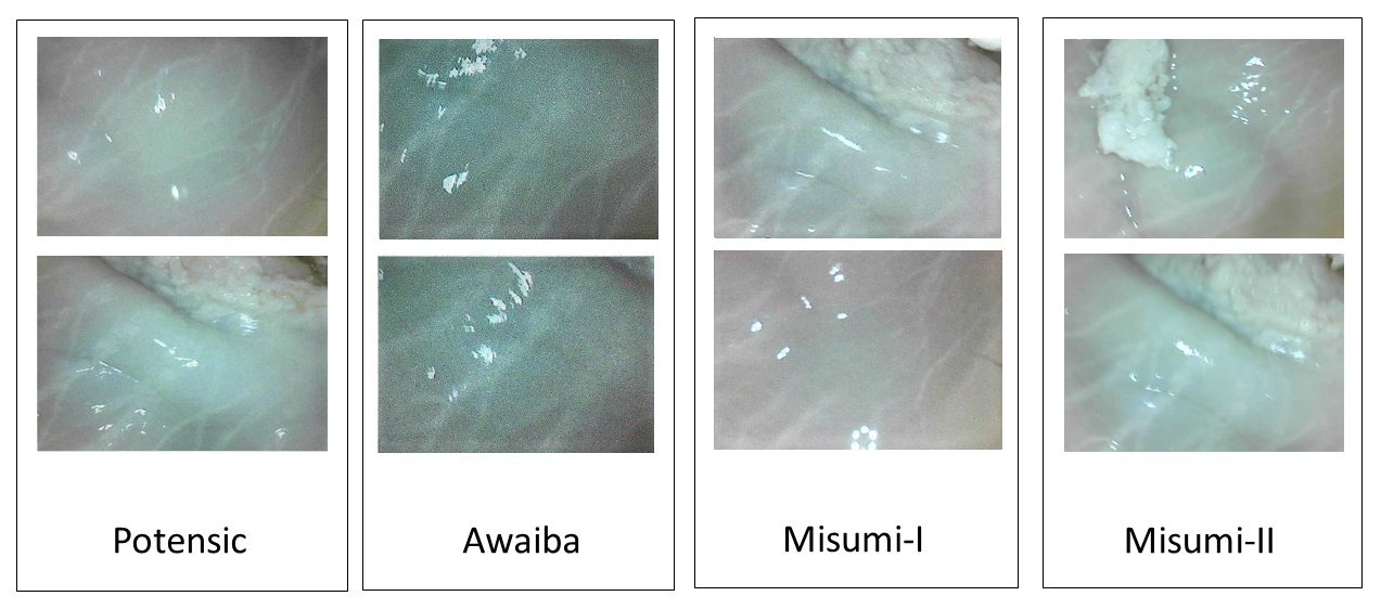 Refer to caption