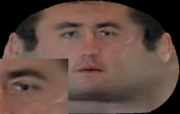 Refer to caption