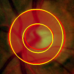 Refer to caption