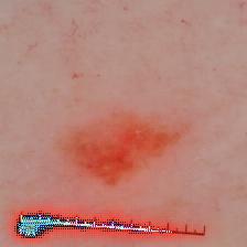 Refer to caption
