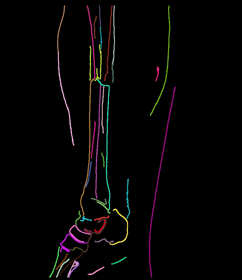 Refer to caption