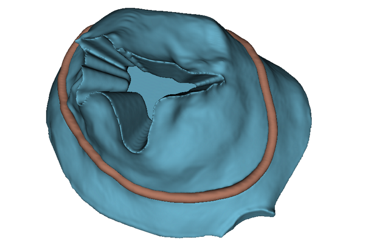 Refer to caption