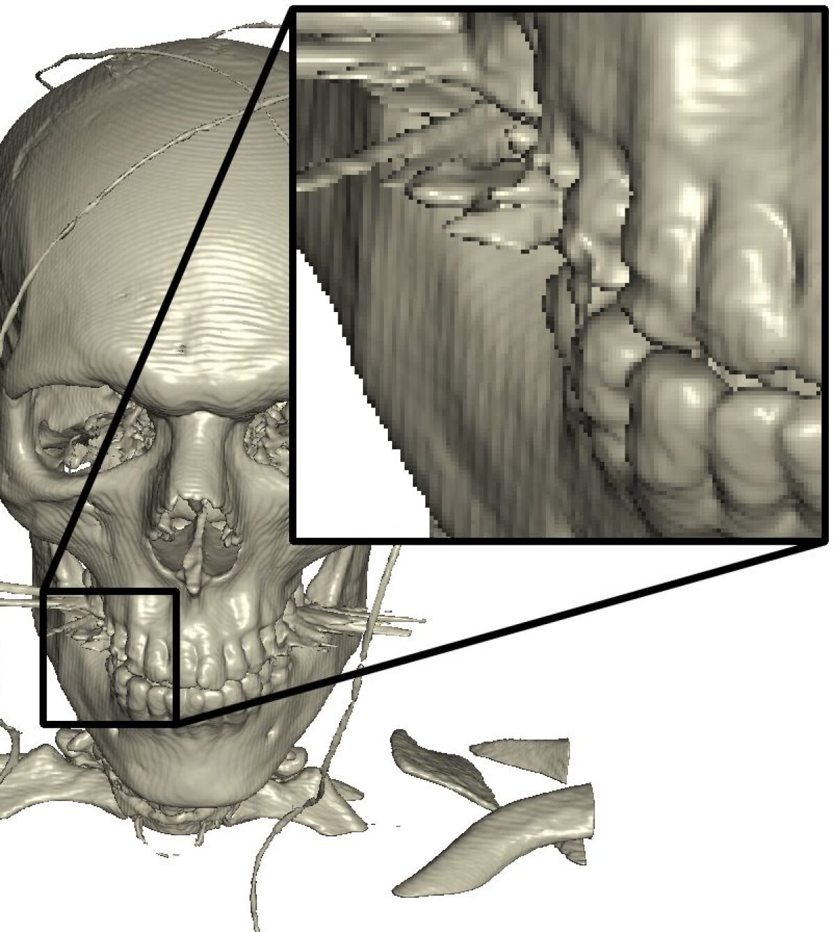 Refer to caption