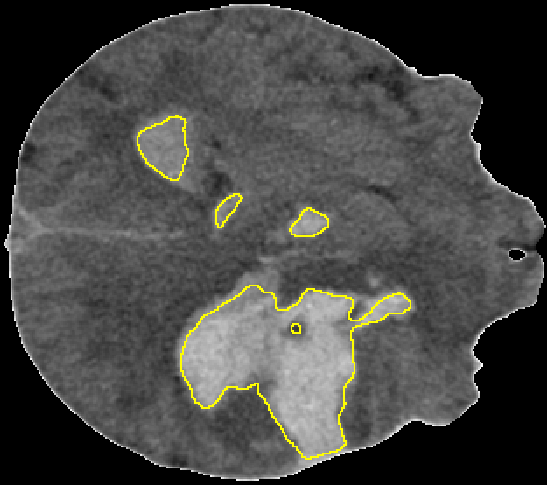 Refer to caption