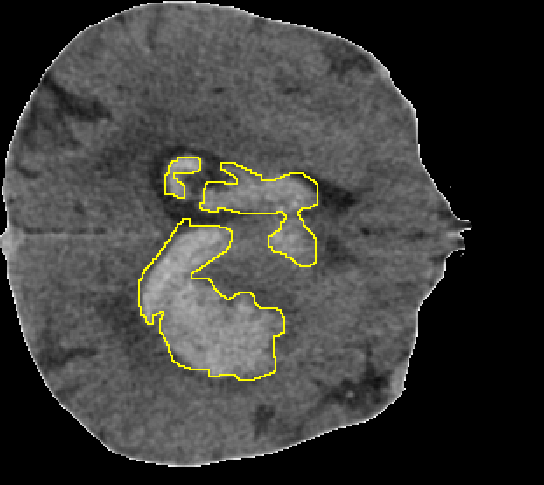 Refer to caption