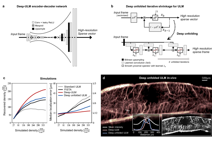 [1907.02994] Deep learning in Ultrasound Imaging