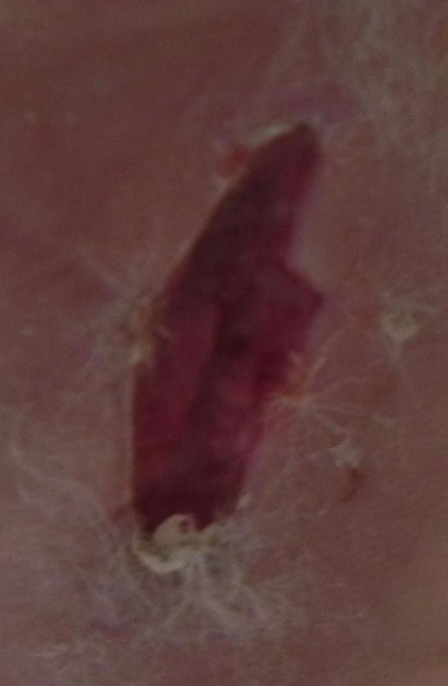 Refer to caption