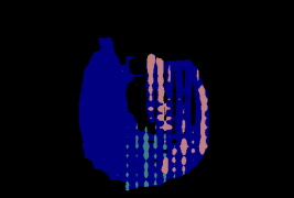 Refer to caption