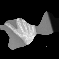 Refer to caption
