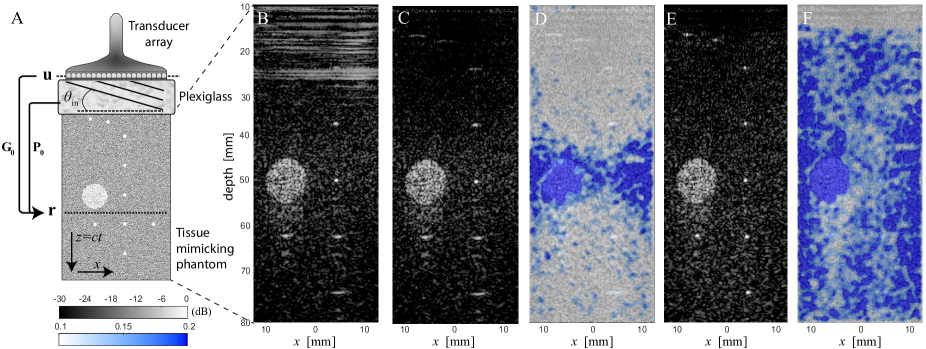 [1912.05417] Distortion matrix approach for ultrasound imaging of ...