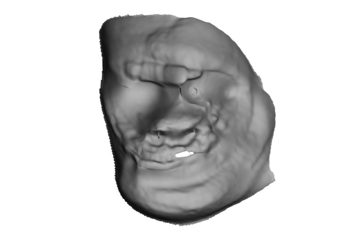 [Uncaptioned image]