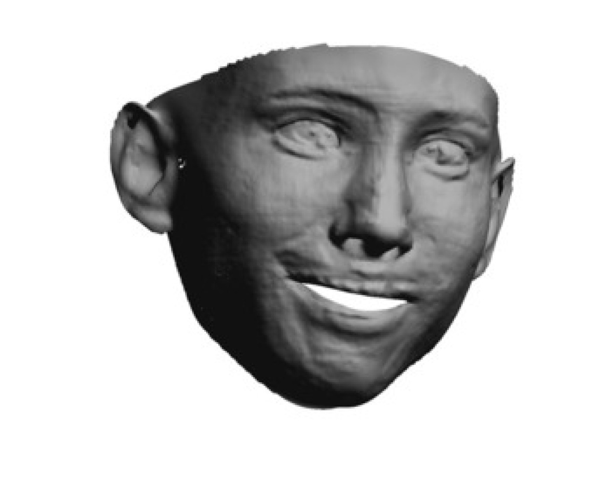 Refer to caption