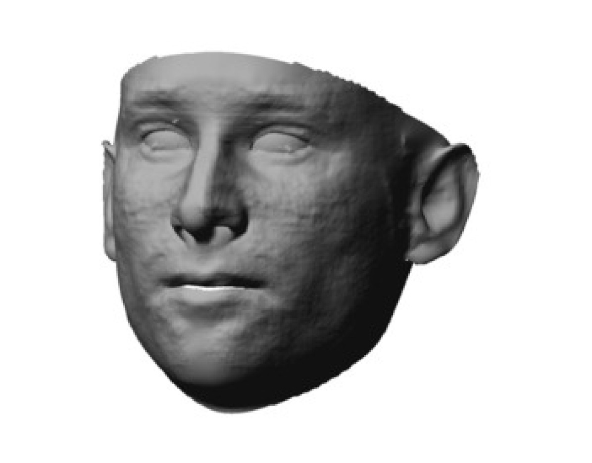 Refer to caption