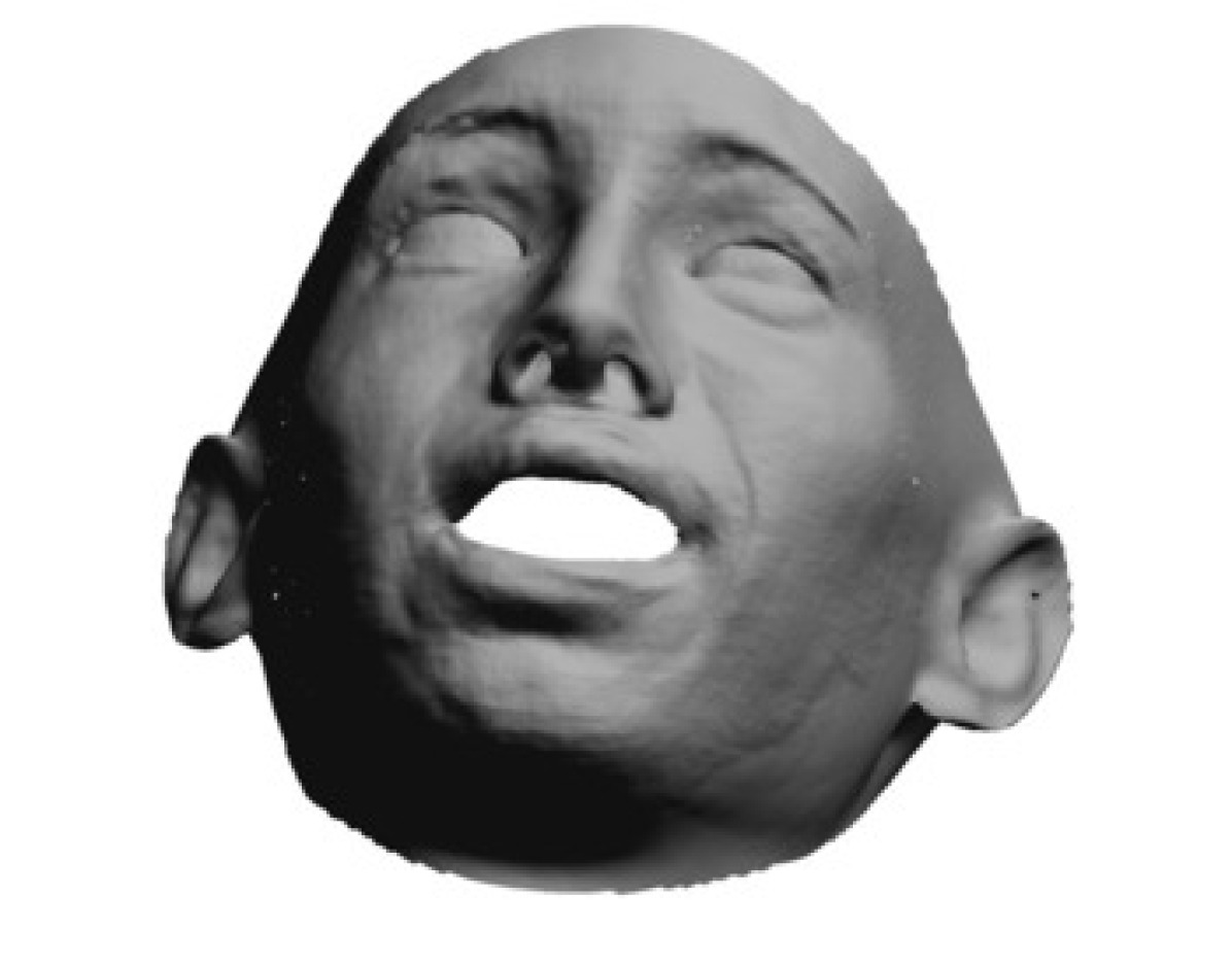 Refer to caption