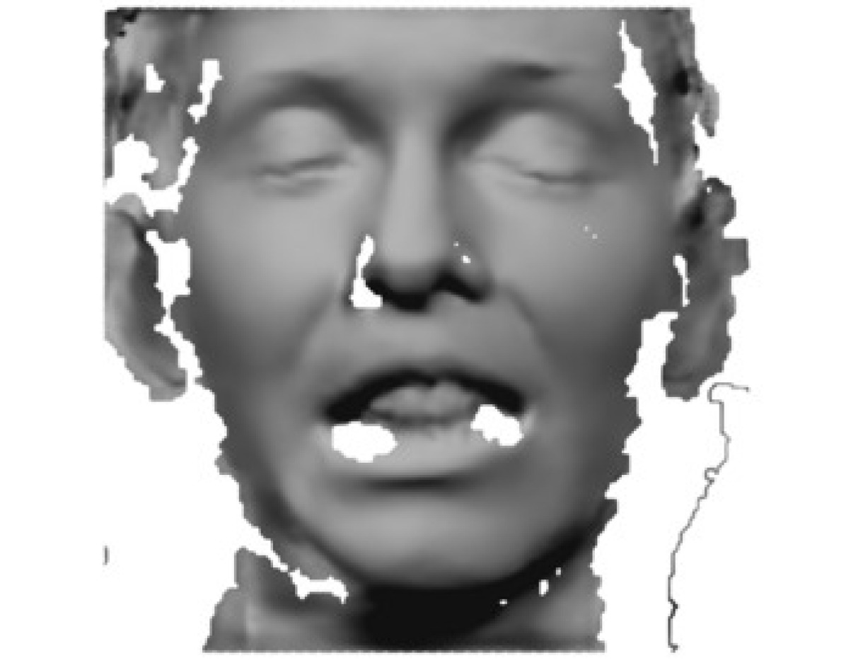 Refer to caption