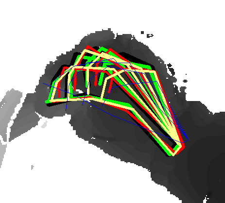 Refer to caption