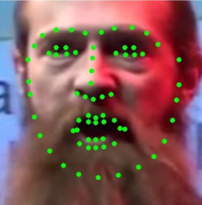 Refer to caption