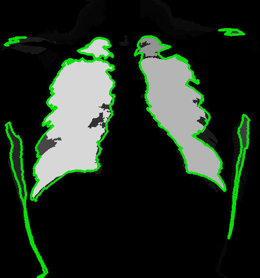 Refer to caption