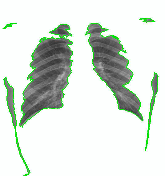 Refer to caption
