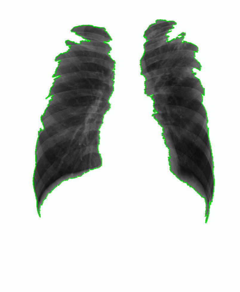 Refer to caption