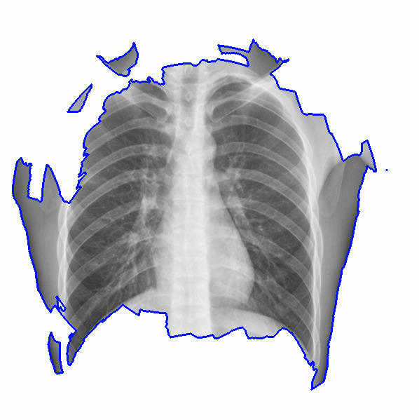 Refer to caption