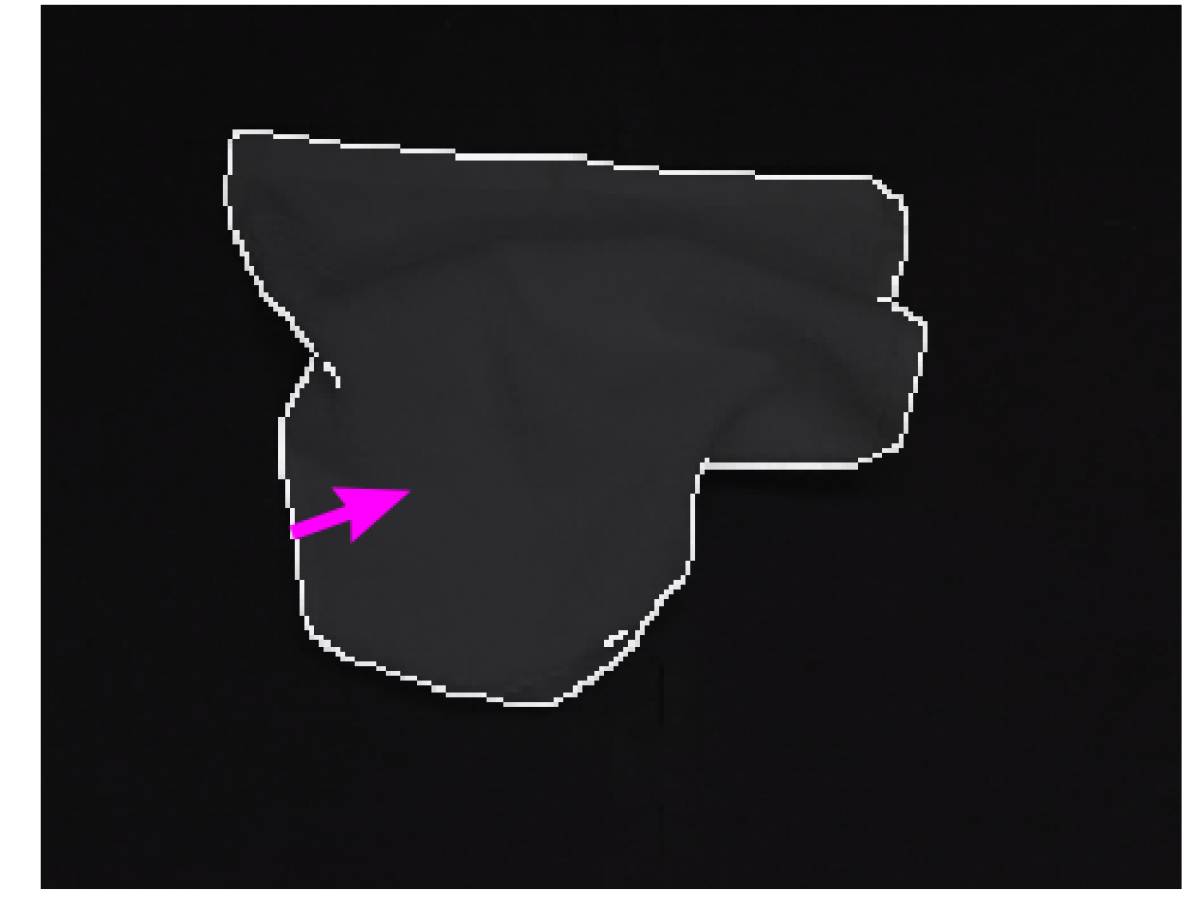 Refer to caption