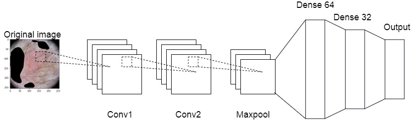 Refer to caption