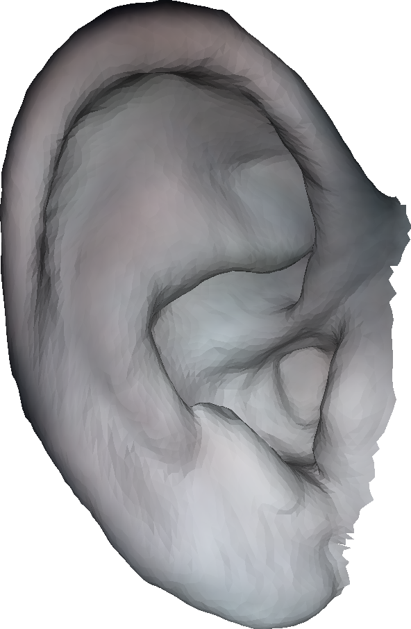 Refer to caption