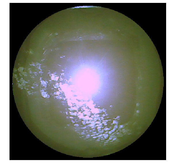 Refer to caption