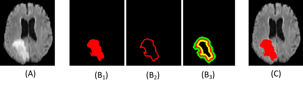 Refer to caption