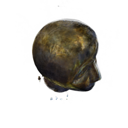 Refer to caption