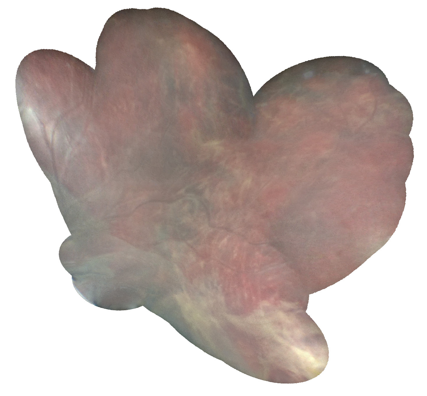 Refer to caption