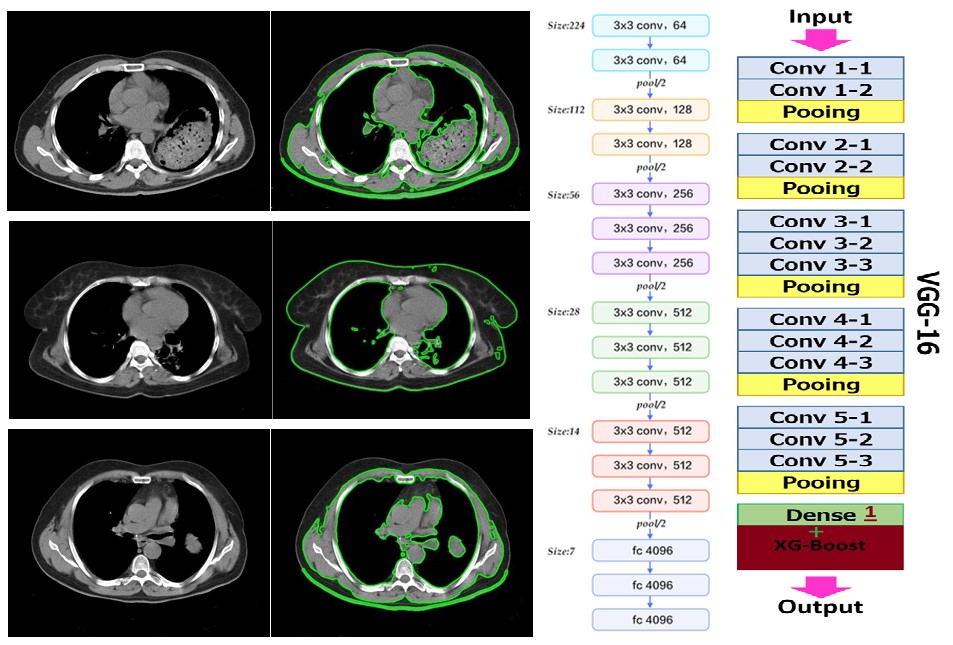 [2101.00948] Classification and Segmentation of Pulmonary Lesions in CT ...