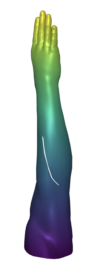 Refer to caption