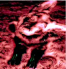 [Uncaptioned image]