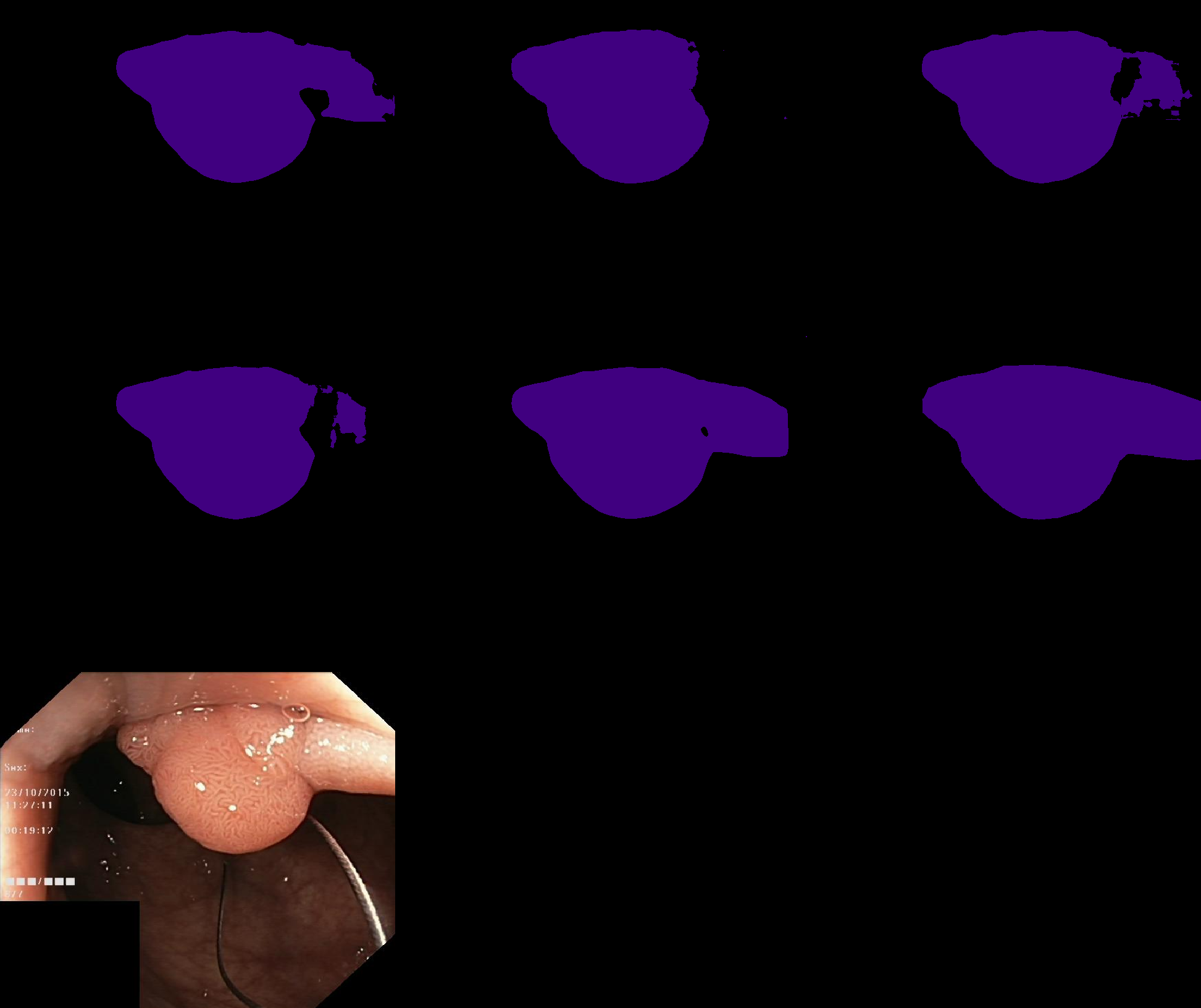 Refer to caption
